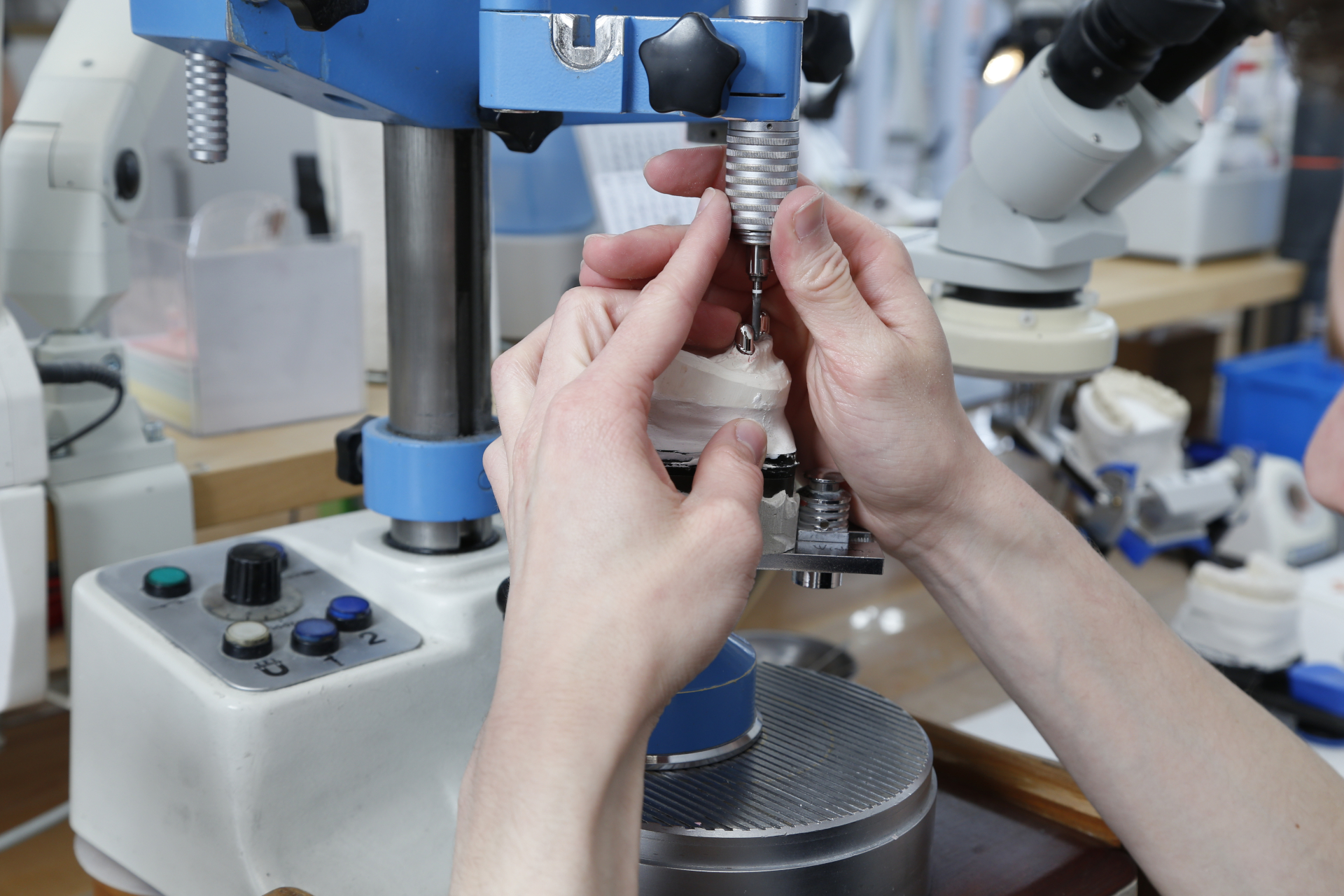 Implantatversorgung mit Titanbalken